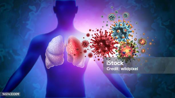 Triple Virus Lung Infection Stock Photo - Download Image Now - Virus, Cold And Flu, Respiratory syncytial virus