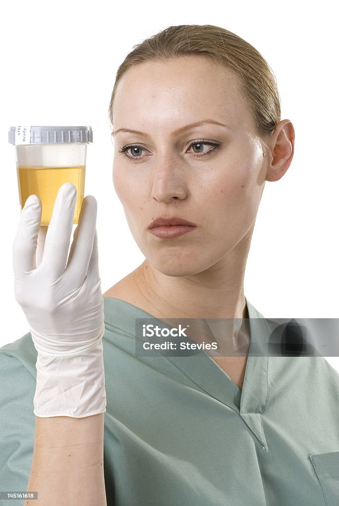 Rivedere il campione di urina - Foto stock royalty-free di Controllo antidoping