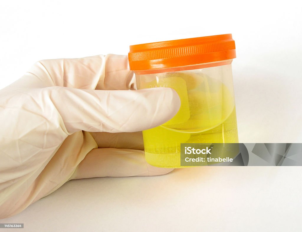 Mano agarrando muestra médica - Foto de stock de Amarillo - Color libre de derechos