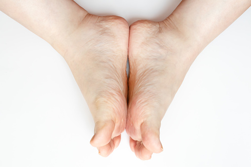 Women's feet.