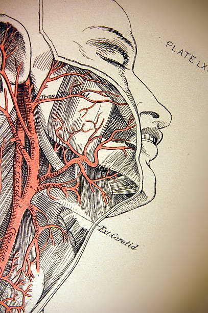 アンティーク医療イラストレーション/頚動脈 - dissection点のイラスト素材／クリップアート素材／マンガ素材／アイコン素材