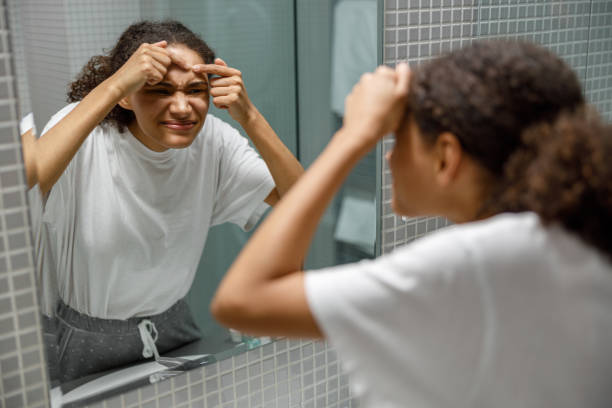 istock Upset young african woman removing pimple from her face while looking at mirror in bathroom home 1451832901