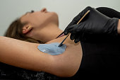 cosmetologist applies hair removal gel to the patient's body.