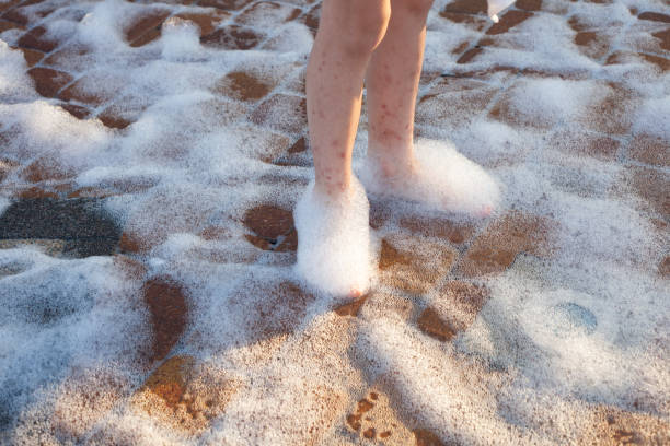 istock children's feet with bite marks in soap foam 1452150641