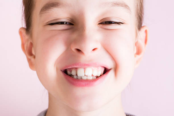 porträt eines mädchens mit schiefen zähnen auf rosa hintergrund. zahnmedizin und kieferorthopädie - fehlbiss stock-fotos und bilder