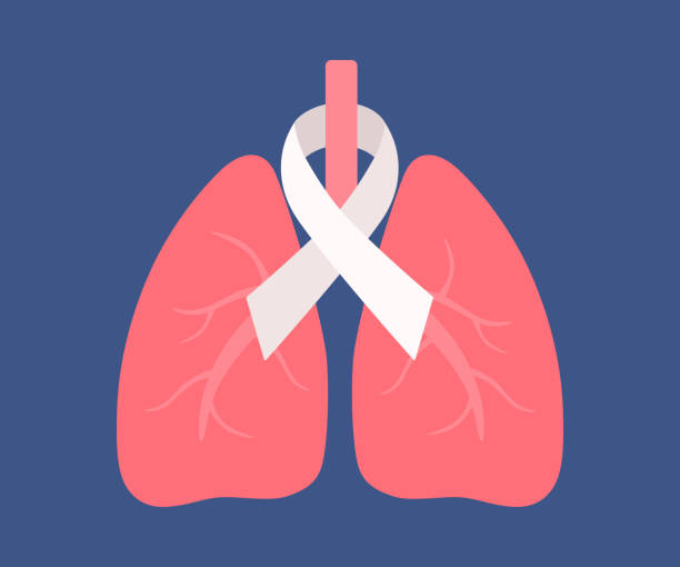 ilustrações de stock, clip art, desenhos animados e ícones de human lungs with white cancer ribbon. lung cancer awareness concept - social awareness symbol illustrations