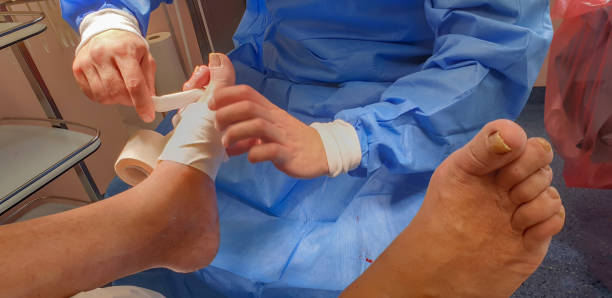 Surgeon operates on a toe and bandaging it stock photo