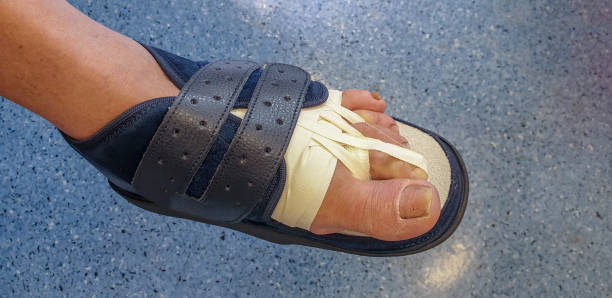 istock Patient's feet bandaged in orthopedic boot 1452554038