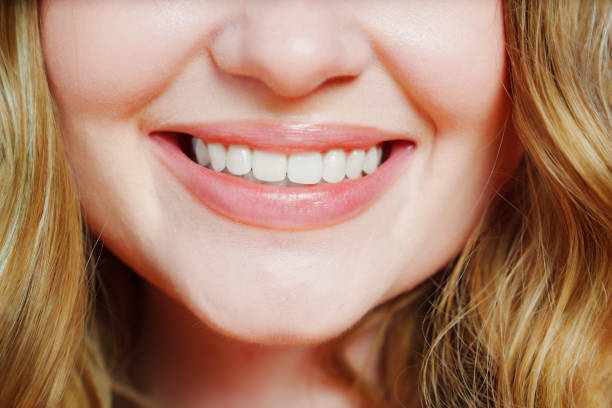 istock close-up. a woman's smile with natural color teeth. 1452854339