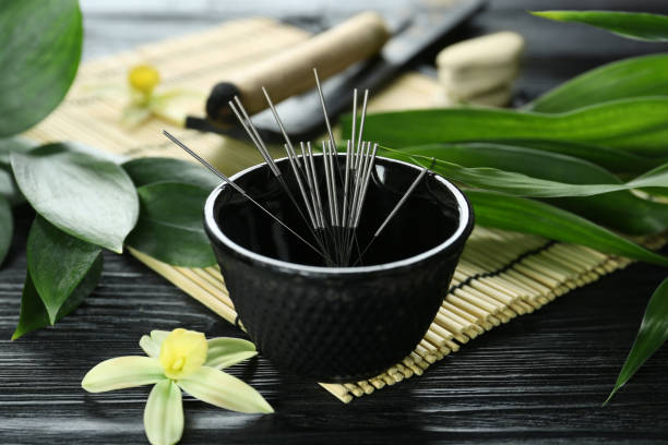 composición con agujas de acupuntura sobre mesa de madera negra - acupuncture needle fotografías e imágenes de stock