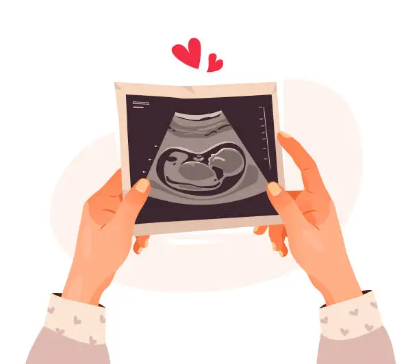 Vector illustration of Hands holding a photo of a baby on ultrasound scan in the womb. Ultrasound of the child. Pregnancy. Cartoon vector illustration