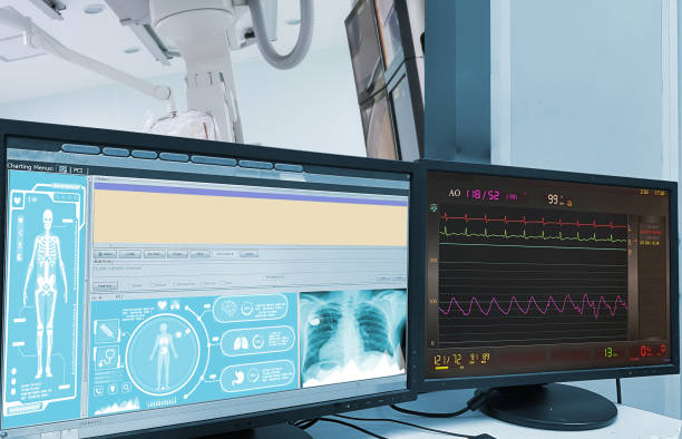 istock percutaneous coronary intervention (PCI)Cardiac Catheterization with Coronary Angiography on blurry Cardiac Catherization Lab Room. Medical healthcare and technology concept. 1452990965