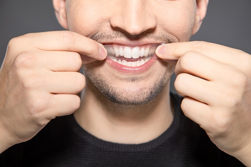 Primer plano de un joven que se aplica una tira blanqueadora en los dientes con las manos mientras, sonríe a la cámara. photo