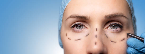 surgeon marking woman's face for cosmetic plastic surgery. facelift procedure. banner with copy space stock photo