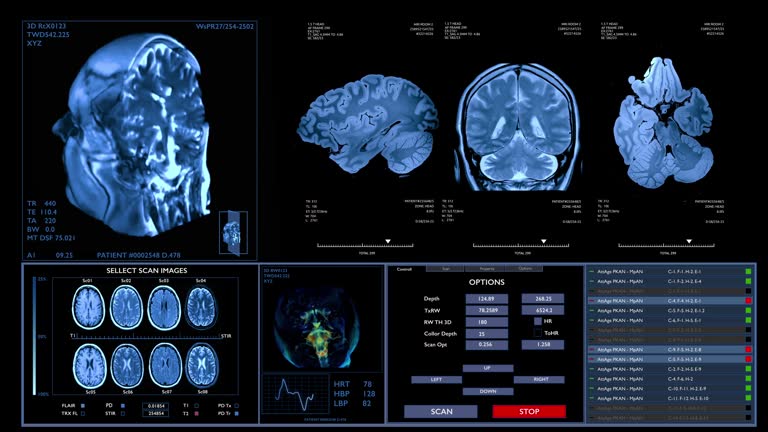 MRI brain scanning animation. Neurology data, vital signs on display Future technology. HUD, interface concept.