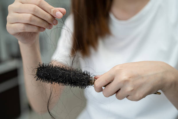 istock Asian woman have problem with long hair loss attach to comb brush. 1453285997