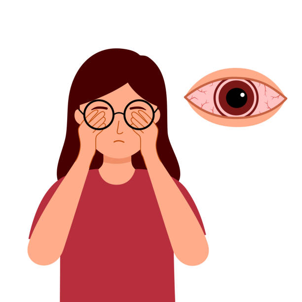 フラットデザインの目の痛みを持つ女性。痛い目のコンセプトベクトルイラスト。 - sore eyes点のイラスト素材／クリップアート素材／マンガ素材／アイコン素材