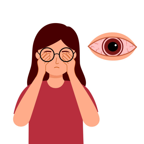 Woman with eye pain in flat design. Sore eye concept vector illustration. vector art illustration