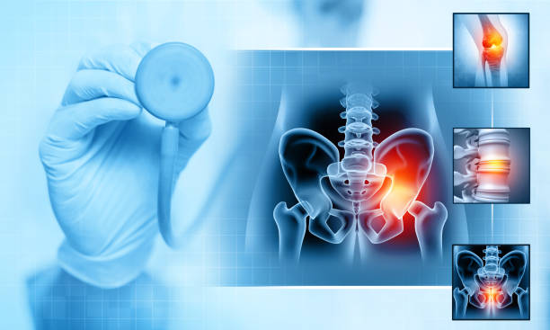 el ortopedista revisa y diagnostica los huesos de la pelvis y la cadera, el dolor de la articulación ósea del fémur, la radiografía de la articulación de la cadera y el fémur. ilustración 3d - ligament fotografías e imágenes de stock