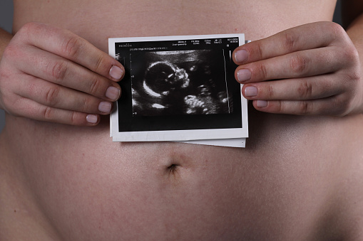 A pregnant woman holds in her hands the first ultrasound photo of her baby against the background of her belly.