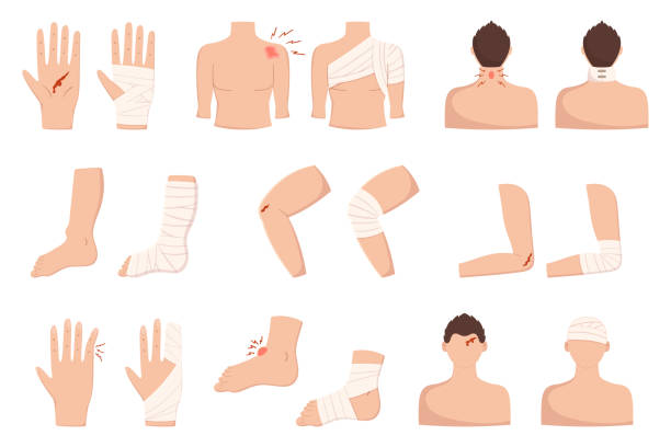 Set of Body Injuries, Palm, Finger, Shoulder or Elbow. Leg, Foot, Knee and Head Trauma with Bandage and Blood, First Aid Set of Body Injuries, Palm, Finger, Shoulder or Elbow. Leg, Foot, Knee and Head Trauma with Bandage and Blood. First Aid, Bandaging Aid Isolated on White Background. Cartoon Vector Illustration bandage arm stock illustrations