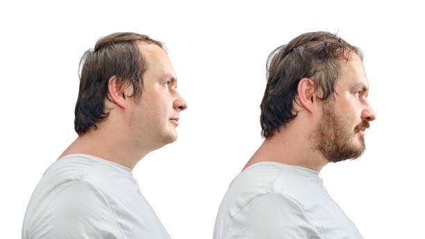 portrait of a man 35-40 years old with a beard and without a beard, face in profile, isolated on a white background. adult man before and after shave - 35 40 years fotos imagens e fotografias de stock