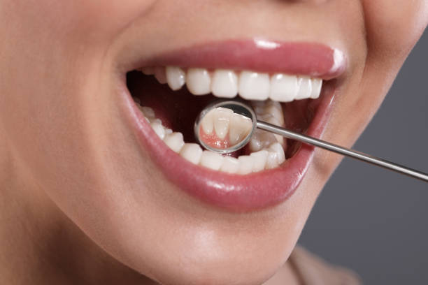 istock Examining woman's teeth with dentist's mirror on grey background, closeup 1453971189