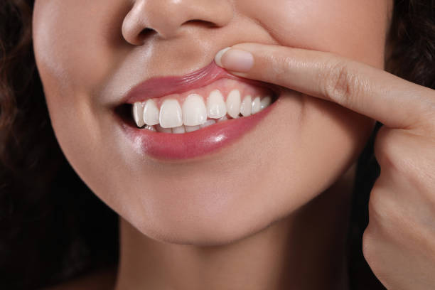 健康な歯茎を示す若い女性、接写 - dentist pain human teeth toothache ストックフォトと画像