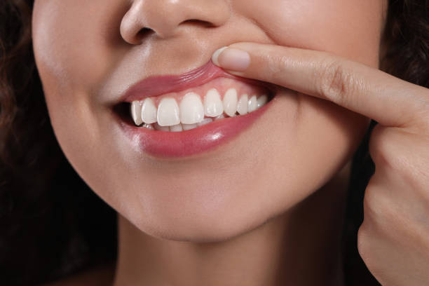 young woman showing healthy gums, closeup view - dentist pain human teeth toothache imagens e fotografias de stock