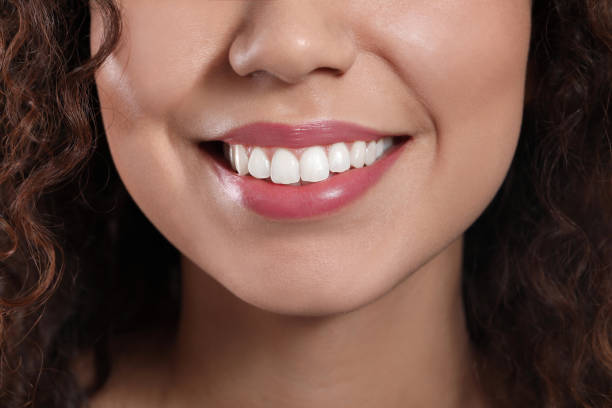 istock Young woman with beautiful smile, closeup view 1453971925