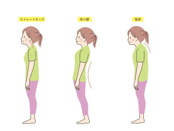 Vector illustration of Sample good and bad posture of women