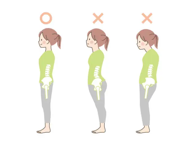 Vector illustration of _Sample of good and bad posture in women_pelvis