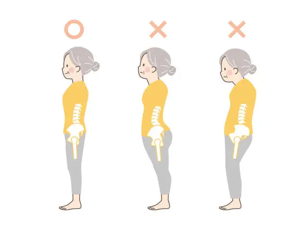 Vector illustration of Sample of good and bad posture of a senior woman_pelvis