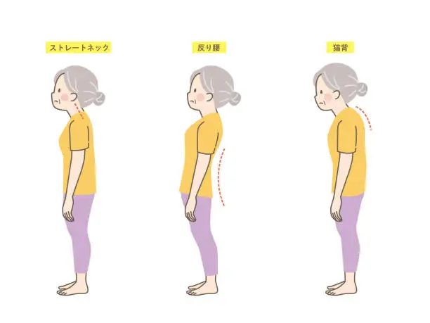 Vector illustration of Examples of good and bad posture of senior women