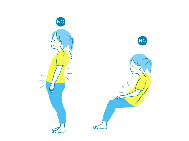 Vector illustration of Illustration set of woman with poor posture