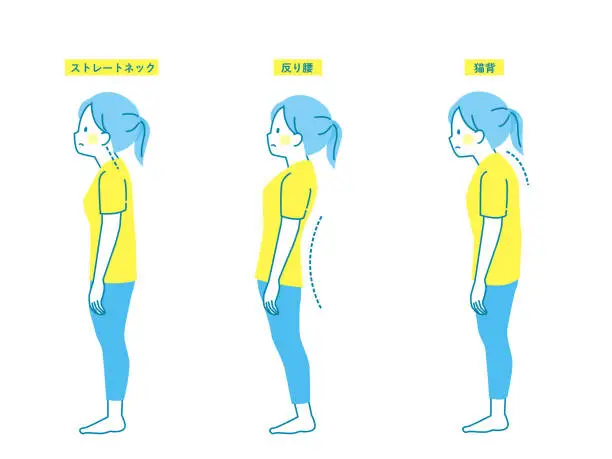 Vector illustration of Sample good and bad posture of women