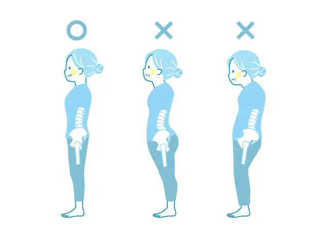 Vector illustration of Sample of good and bad posture of a senior woman_pelvis