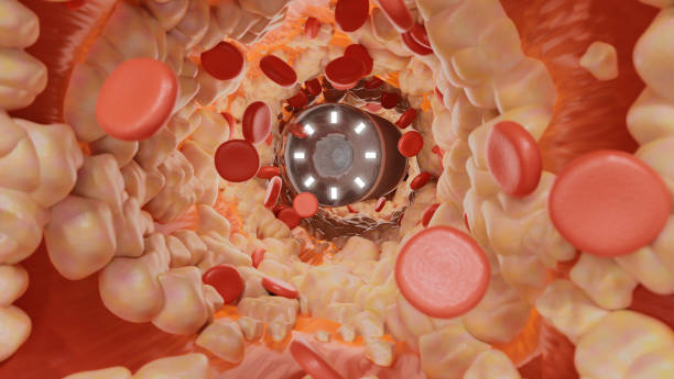 istock Medical diagnostic technology with endoscope camera capsule. 3d render. 1454381816