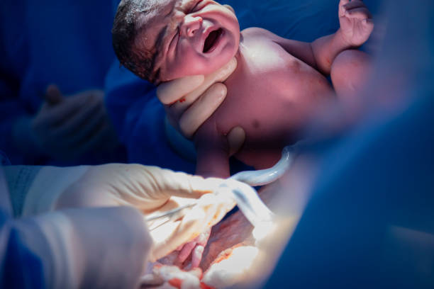 istock Birth of baby in maternity 1454435708
