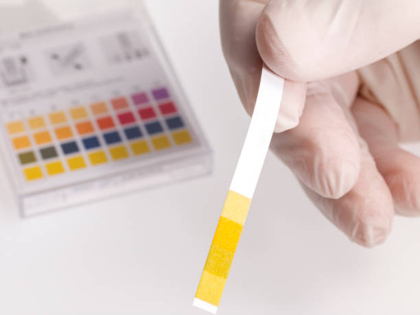 istock Litmus strips for measurement 1454465815