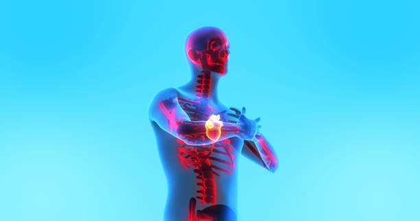 istock Stressed Human Heart. Patient Having Heart Attack. X-Ray Image. 1454581928