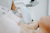 Female laser hair removal Treatment