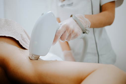 Female laser hair removal Treatment