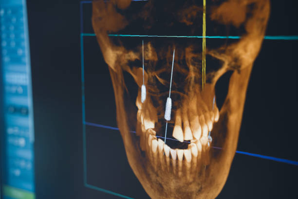 dental radiography x-ray on digital screen in dental clinic stock photo