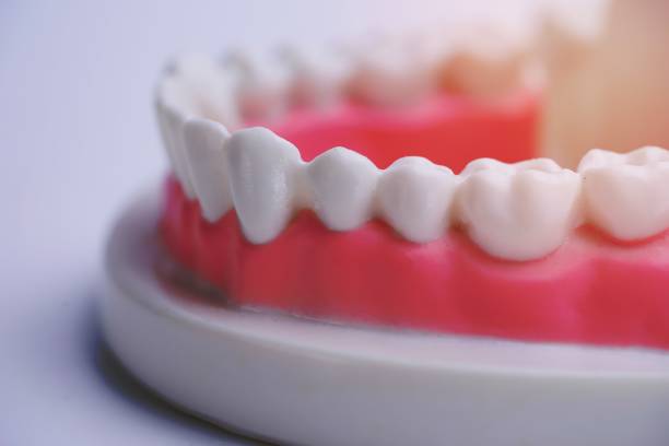 istock Mock Jaw with gum and teeth on white background. 1454647612