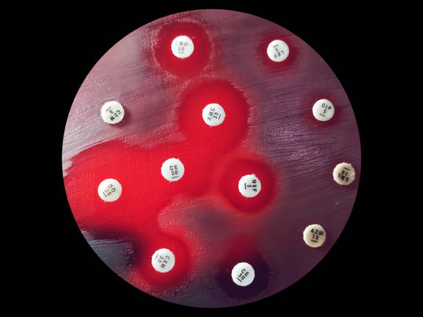 istock Antimicrobial susceptibility testing in petri dish. Antibiotic resistance of bacteria 1454755873