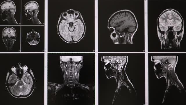 Tomography. MRI scans of the brain. Medical diagnostic examination.