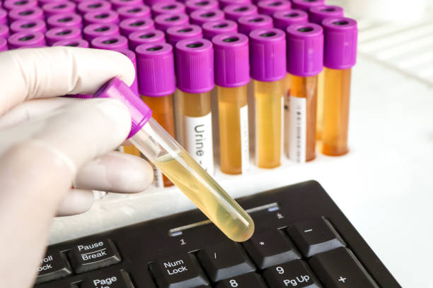istock Urine test to look for abnormalities from Urine,  Urine sample to analyze in the laboratory 1454828124