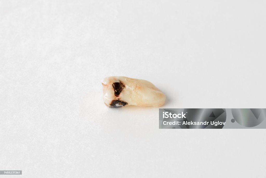Tooth Roots Extracted Extracted Tooth Closeup With Caries And A Whole Root On A White ...