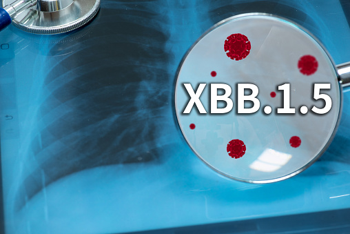 X-ray diagnostics of lung diseases,COVID OMICRON XBB.1.5 and virus 3d model,Medical health concept